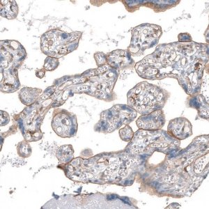Anti-THBD antibody produced in rabbit HPA002982-100UL