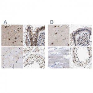 Anti-THOC1 antibody produced in rabbit 