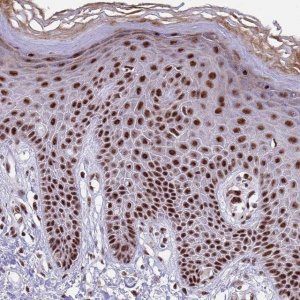 Anti-THOC2 antibody produced in rabbit 