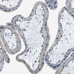 Anti-THSD1 antibody produced in rabbit 