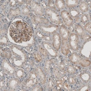 Anti-THSD7A antibody produced in rabbit 