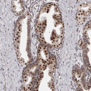 Anti-THUMPD1 antibody produced in rabbit 