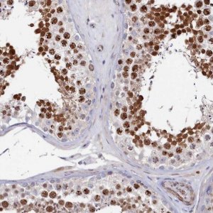 Anti-TIGD4 antibody produced in rabbit 