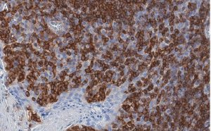 Anti-TIGIT Antibody, clone 1D20 ZooMAb Rabbit Monoclonal 