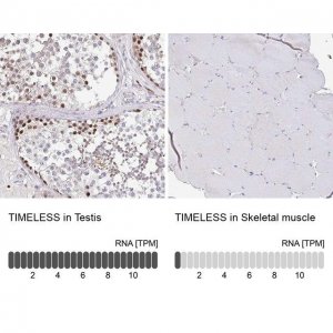 Anti-TIMELESS antibody produced in rabbit 