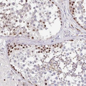 Anti-TIMELESS antibody produced in rabbit 
