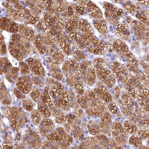 Anti-TIMM22 antibody produced in rabbit 