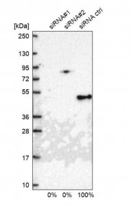 Anti-TIMM44 antibody produced in rabbit 