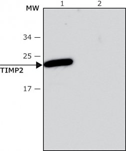 Anti-TIMP2 antibody, Mouse monoclonal 