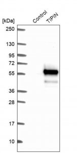Anti-TIPIN antibody produced in rabbit 