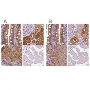 Anti-TKFC antibody produced in rabbit 