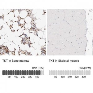 Anti-TKT antibody produced in rabbit 