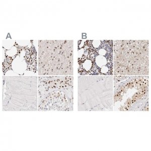 Anti-TKT antibody produced in rabbit 