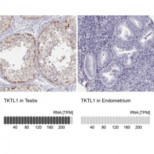 Anti-TKTL1 antibody produced in rabbit 