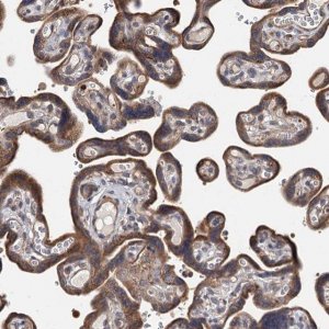 Anti-TLDC1 antibody produced in rabbit 
