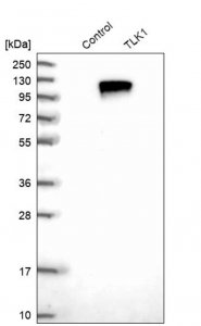 Anti-TLK1 antibody produced in rabbit 