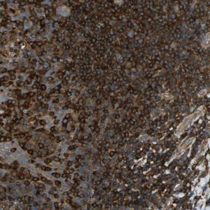 Anti-TLN1 antibody produced in rabbit 