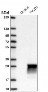 Anti-TM2D2 antibody produced in rabbit 