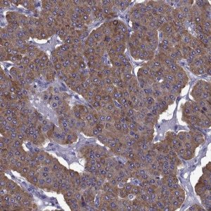 Anti-TMC3 antibody produced in rabbit 