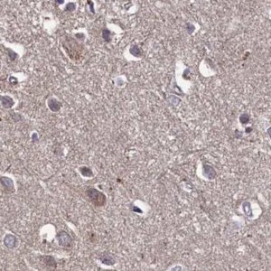 Anti-TMC5 antibody produced in rabbit 