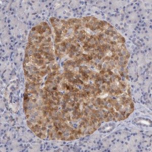 Anti-TMED8 antibody produced in rabbit 