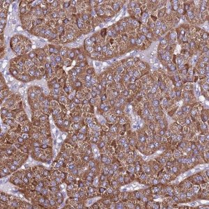 Anti-TMEM106C antibody produced in rabbit 