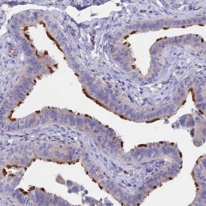 Anti-TMEM138 antibody produced in rabbit 