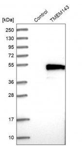 Anti-TMEM143 antibody produced in rabbit 