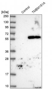 Anti-TMEM151A antibody produced in rabbit HPA041035-100UL
