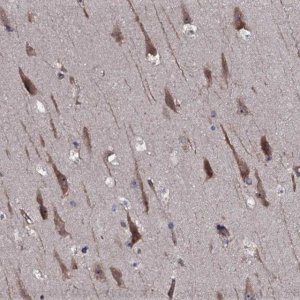 Anti-TMEM151A antibody produced in rabbit HPA041035-100UL