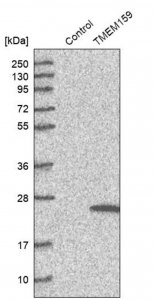 Anti-TMEM159 antibody produced in rabbit 