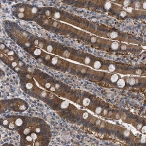 Anti-TMEM159 antibody produced in rabbit 