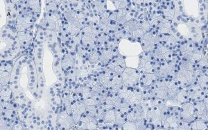 Anti-TMEM16A Antibody, clone 3J18, ZooMAb Rabbit Monoclonal 