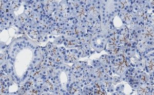 Anti-TMEM16A Antibody, clone 3J18, ZooMAb Rabbit Monoclonal 