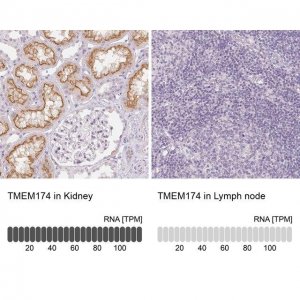 Anti-TMEM174 antibody produced in rabbit 