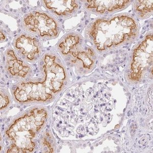 Anti-TMEM174 antibody produced in rabbit 