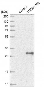 Anti-TMEM179B antibody produced in rabbit HPA016585-100UL