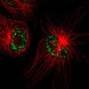 Anti-TMEM179B antibody produced in rabbit HPA016585-100UL
