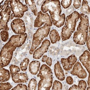 Anti-TMEM184B antibody produced in rabbit HPA024076-100UL