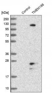 Anti-TMEM186 antibody produced in rabbit HPA018226-100UL