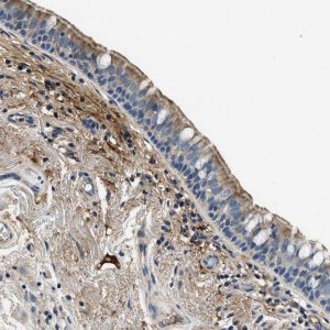Anti-TMEM186 antibody produced in rabbit HPA018226-100UL