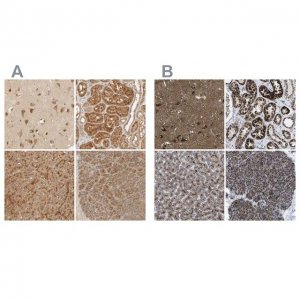 Anti-TMEM192 antibody produced in rabbit 