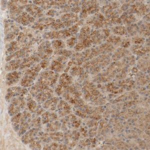 Anti-TMEM192 antibody produced in rabbit 