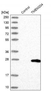 Anti-TMEM204 antibody produced in rabbit 