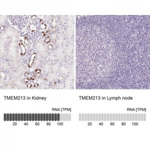 Anti-TMEM213 antibody produced in rabbit 