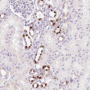 Anti-TMEM213 antibody produced in rabbit 
