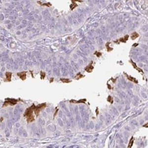 Anti-TMEM237 antibody produced in rabbit 