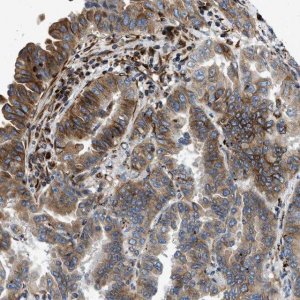 Anti-TMEM248 antibody produced in rabbit HPA016495-100UL