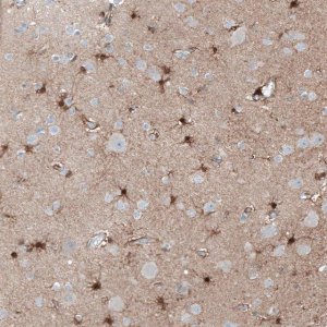 Anti-TMEM255A antibody produced in rabbit HPA048470-100UL