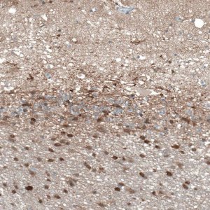 Anti-TMEM255A antibody produced in rabbit HPA048470-100UL